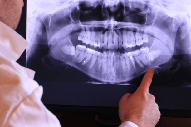 Best Emergency Treatment for Toothache in Ellwood City, PA