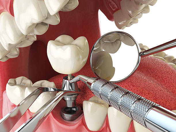 Best Emergency Dental Care for Trauma or Injury in Ellwood City, PA